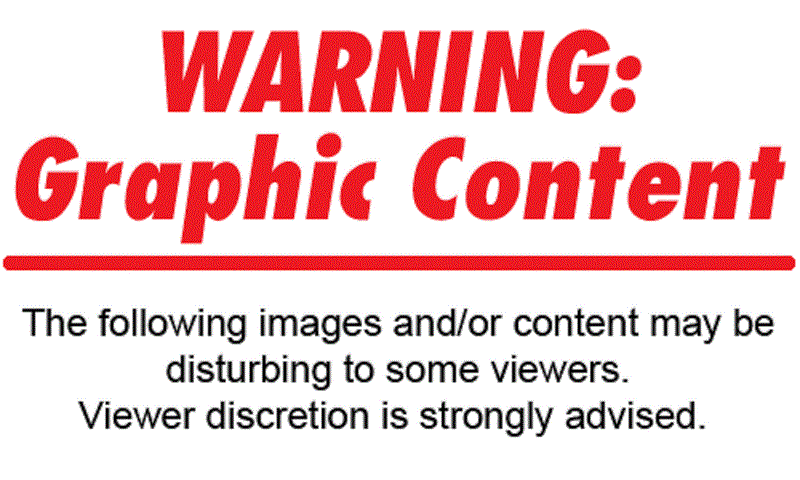 warning.gif