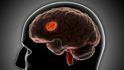 Why Your Brain Craves Familiar Pain Over Unfamiliar Peace