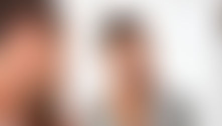 Breaking the Silence Around Hyperpigmentation and Confidence for Men