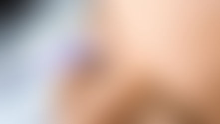 Beauty and Botched Botox