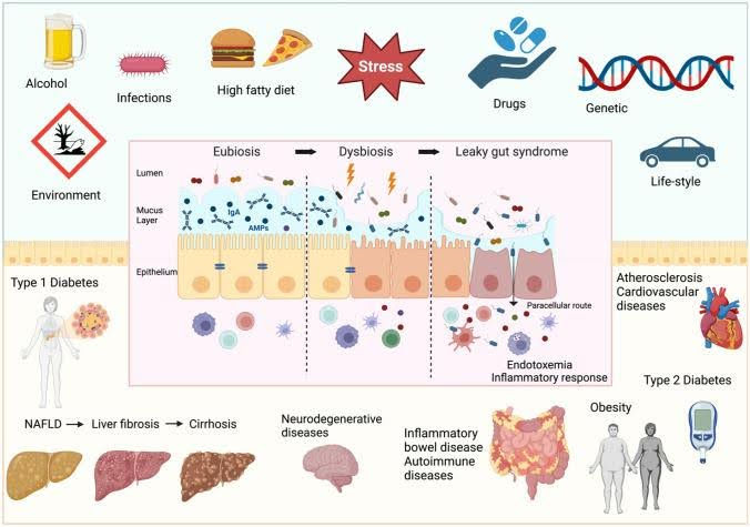 Figure 1: Factors determining intestinal barrier impairment and consequent systemic diseases