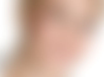 Do you feel that you have a Gummy Smile or an Uneven Gum Line?