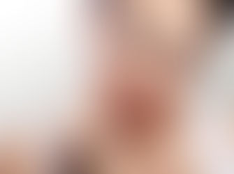 How to help prevent tooth sensitivity