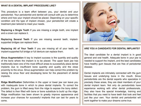 Information on Dental Implants