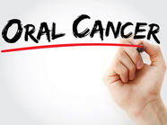 Oral Cancer - Symptoms, Common Risk Factors and Prevention