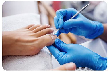 debridement