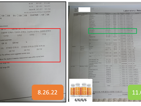 간수치 갑상선 기능저하: Mrs. Li