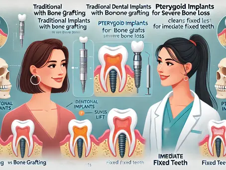 Pterygoid Implants in Chandigarh: A Breakthrough for Patients with Severe Bone Loss