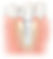 Zirconia implants in India