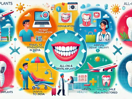 All-on-4 dental implants Treatment Process in India for American Patients: step by step