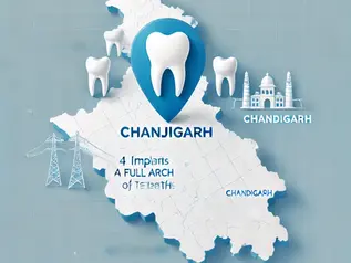 Best All-on-4 Dental Implants in Punjab: Affordable Full-Mouth Rehabilitation for NRIs