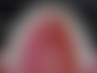 **Lingual Braces in Chandigarh: A Hidden Gem for Teeth Alignment**