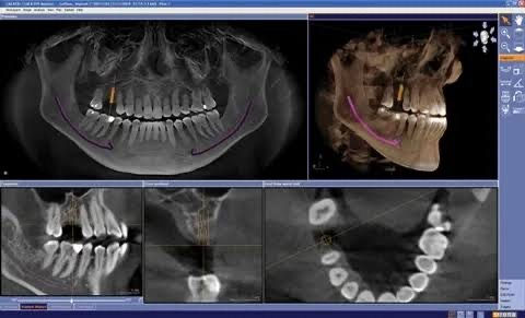 3D CBCT Imaging in Chandigarh 