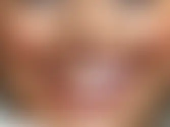 Affordable Smile Makeovers in India: What’s Included and What It Costs