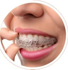 Best invisible braces dentist in Chandigarh