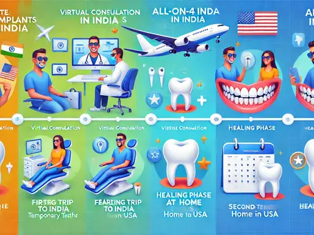 How Much Time Do All-on-4 Implants in India Take? A Guide for Americans on Short Visits
