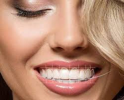 Navigating Dental Insurance in India for NRIs: What You Need to Know"