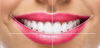Best veneer specialist India , Best veneers at affordable prices India , Best veneers at best prices India