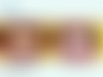 Porcelain Veneers for teeth Fluorosis in India : Best Treatment for Discolored Teeth | Advanced Dental Care Center , Chandigarh