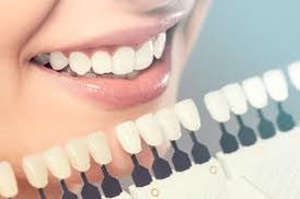 Dentist Mohali , best dentist Mohali , best dentist near you Mohali