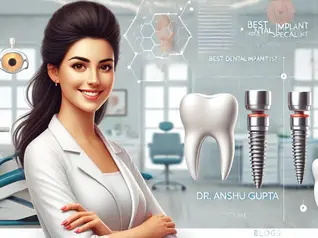 Best implant service doctors in chandigarh