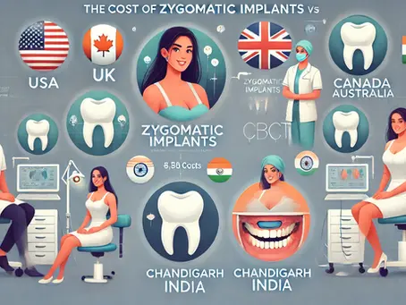 Cost of Zygomatic Implants in Chandigarh vs. USA, UK, Canada, and Australia