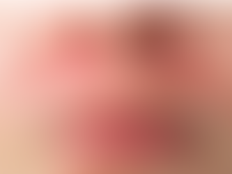 Skin Conditions Decoded: What Your Skin is Telling You (and how to respond)