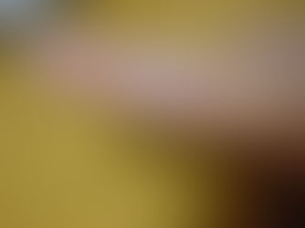 人工皮膚とトランスファーリニューアル