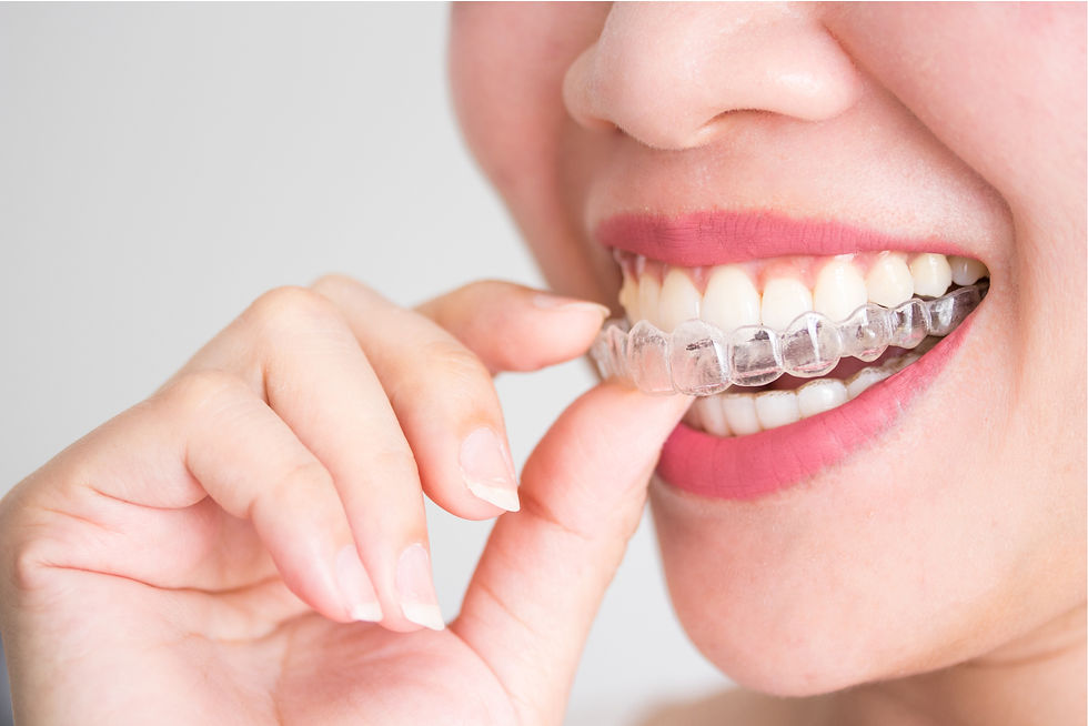 Invisalign vs Traditional Braces: Why Invisalign Often Outshines Traditional Braces