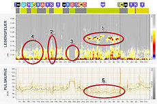 Lebensfeuer HRV, Analyse, Stress, Entspannung, Vagus, Atmen, Herz, Autonom Health, Mallorca, sutter//meier