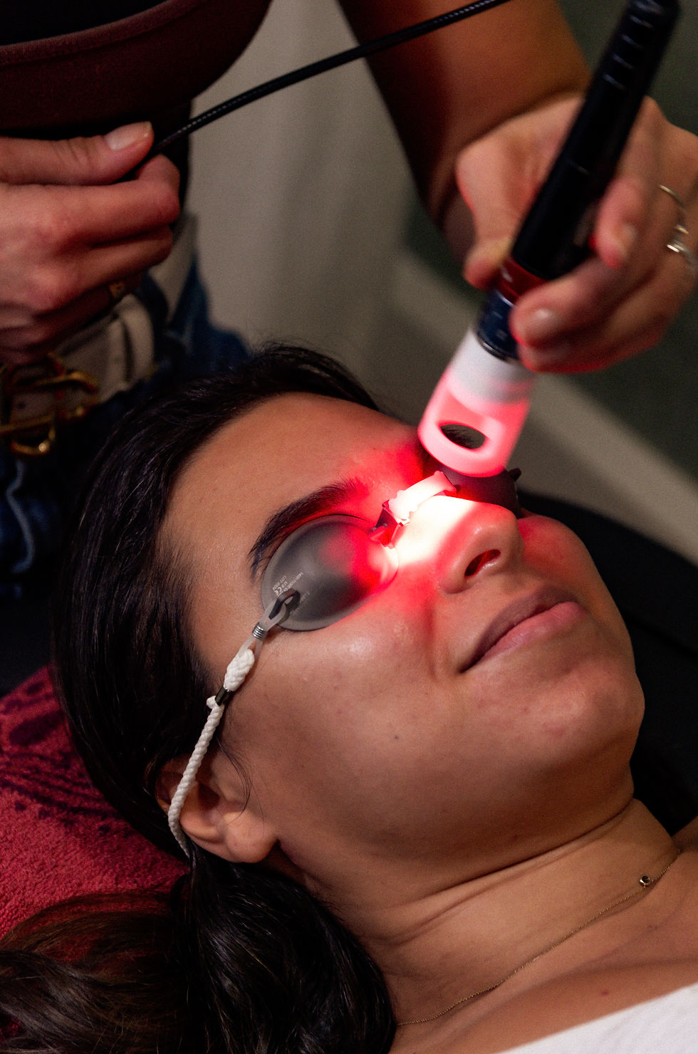 Laser médical sur le visage