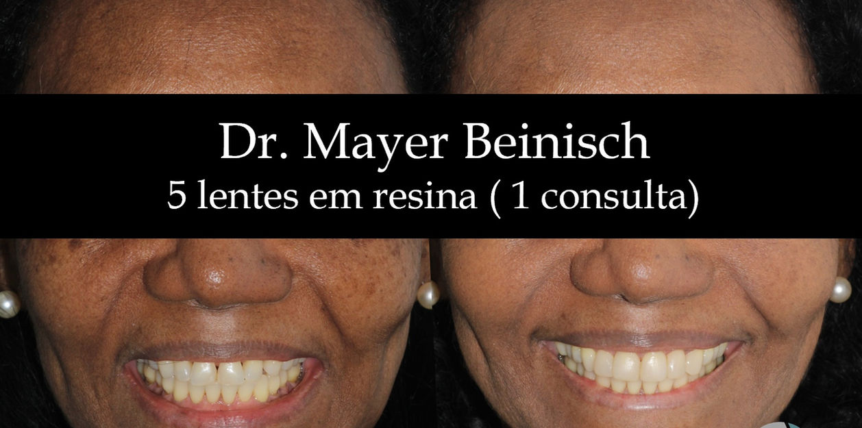Clinica odontologica de alto padrão em higienópolis, focado em estética oral, implantes, invisalign, limpeza, raspagem emergencia, aparelhos ortodonticos, atendimentos com crianças.
High-end dental clinic in Higienópolis, focused on oral aesthetics, implants, Invisalign, cleaning, emergency scaling, orthodontic appliances, and pediatric care.