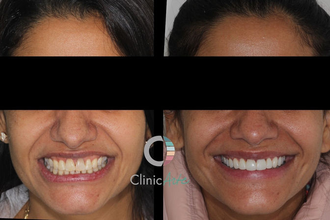 Dentistahigienopolis, estética oral