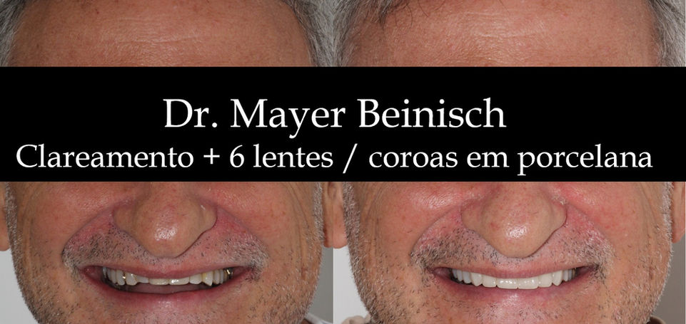 Dentista de qualidade em Higienopolis, são paulo