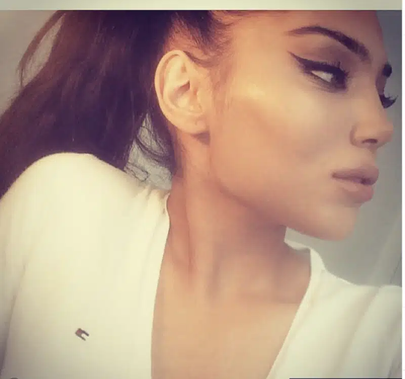 Suleyman Tas reviews – verified rhinoplasty patient review #298