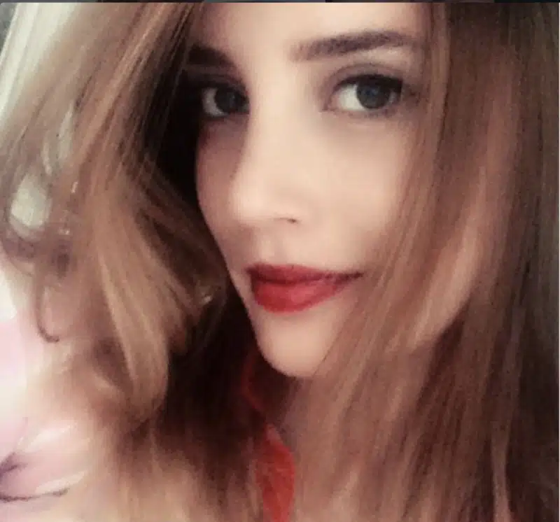 Suleyman Tas reviews – verified rhinoplasty patient review #378