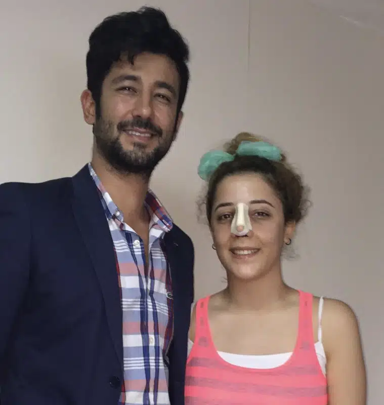 Suleyman Tas reviews – verified rhinoplasty patient review #391
