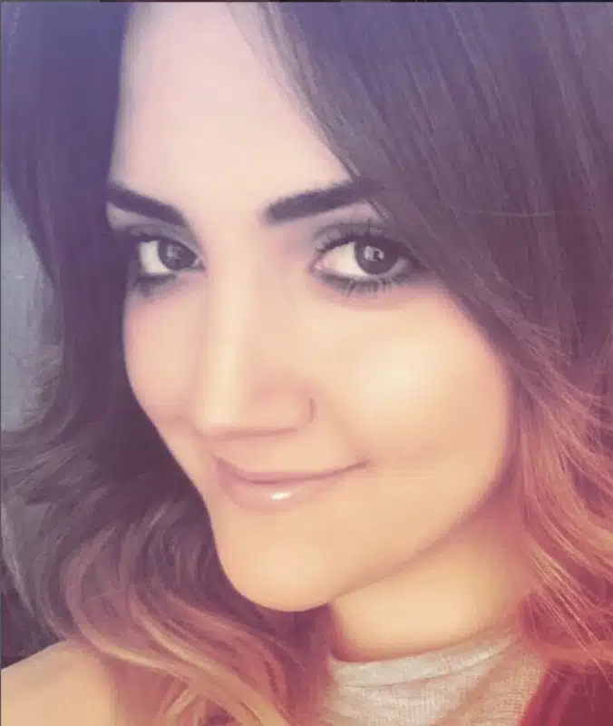 Suleyman Tas reviews – verified rhinoplasty patient review #262