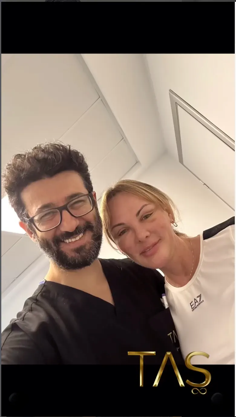 Suleyman Tas reviews – verified facelift patient review #26