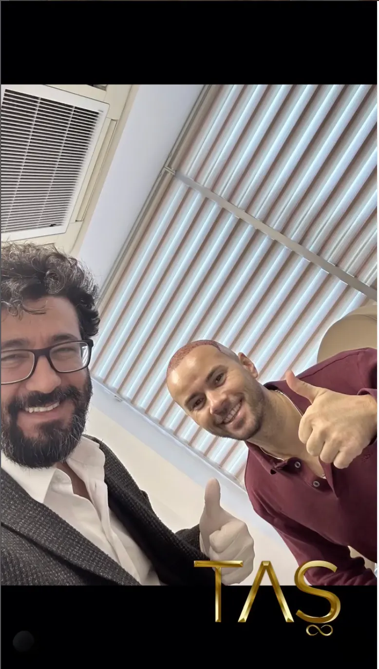 Suleyman Tas reviews – verified hair transplant patient review #18