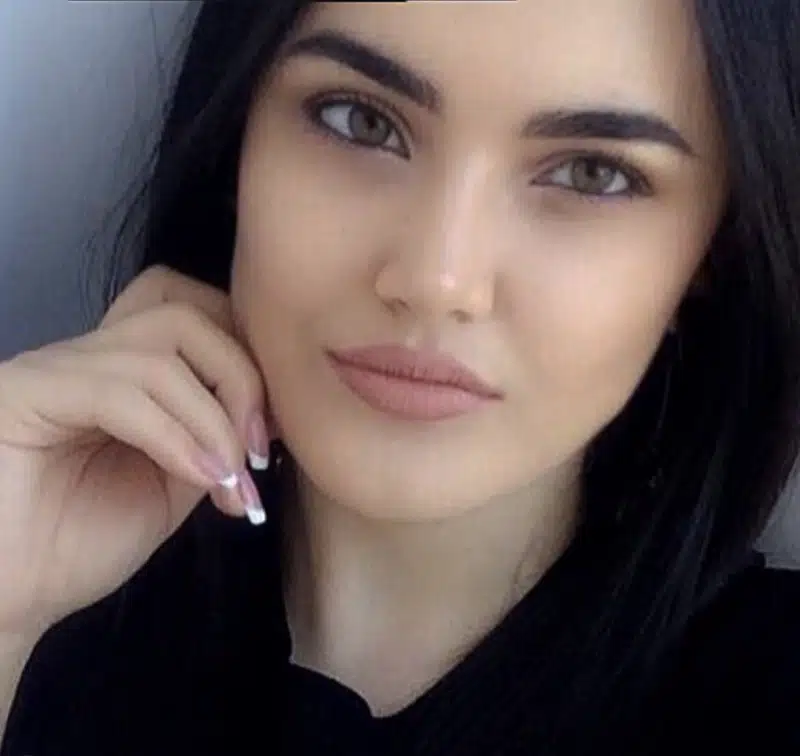 Suleyman Tas reviews – verified rhinoplasty patient review #233
