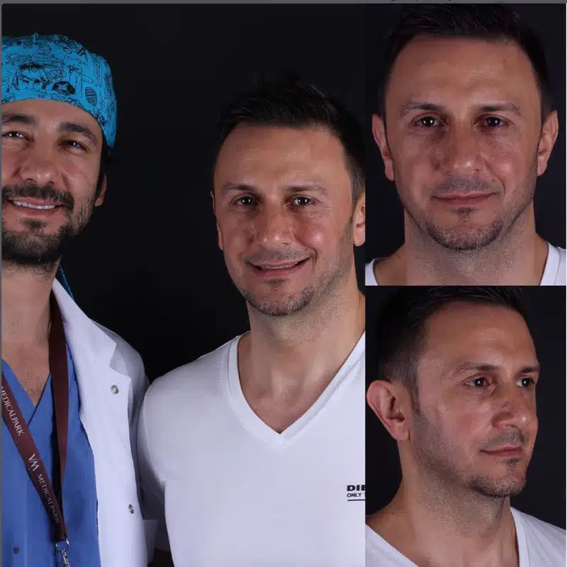 Suleyman Tas reviews – verified plastic surgery patient review #343