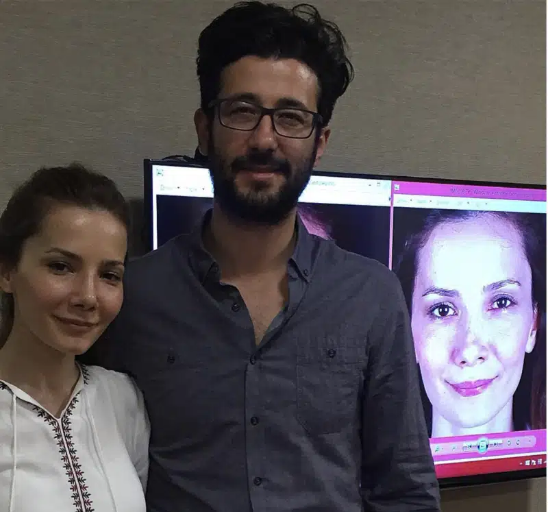 Suleyman Tas reviews – verified rhinoplasty patient review #311