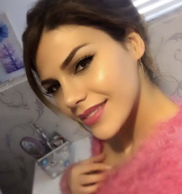 Suleyman Tas reviews – verified rhinoplasty patient review #258