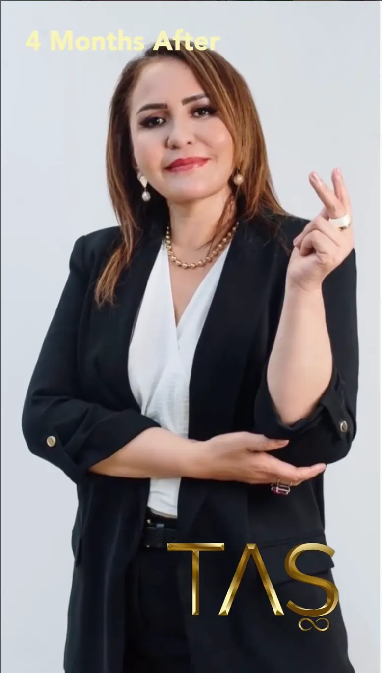 Suleyman Tas reviews – verified facelift patient review #29 (photo 1)
