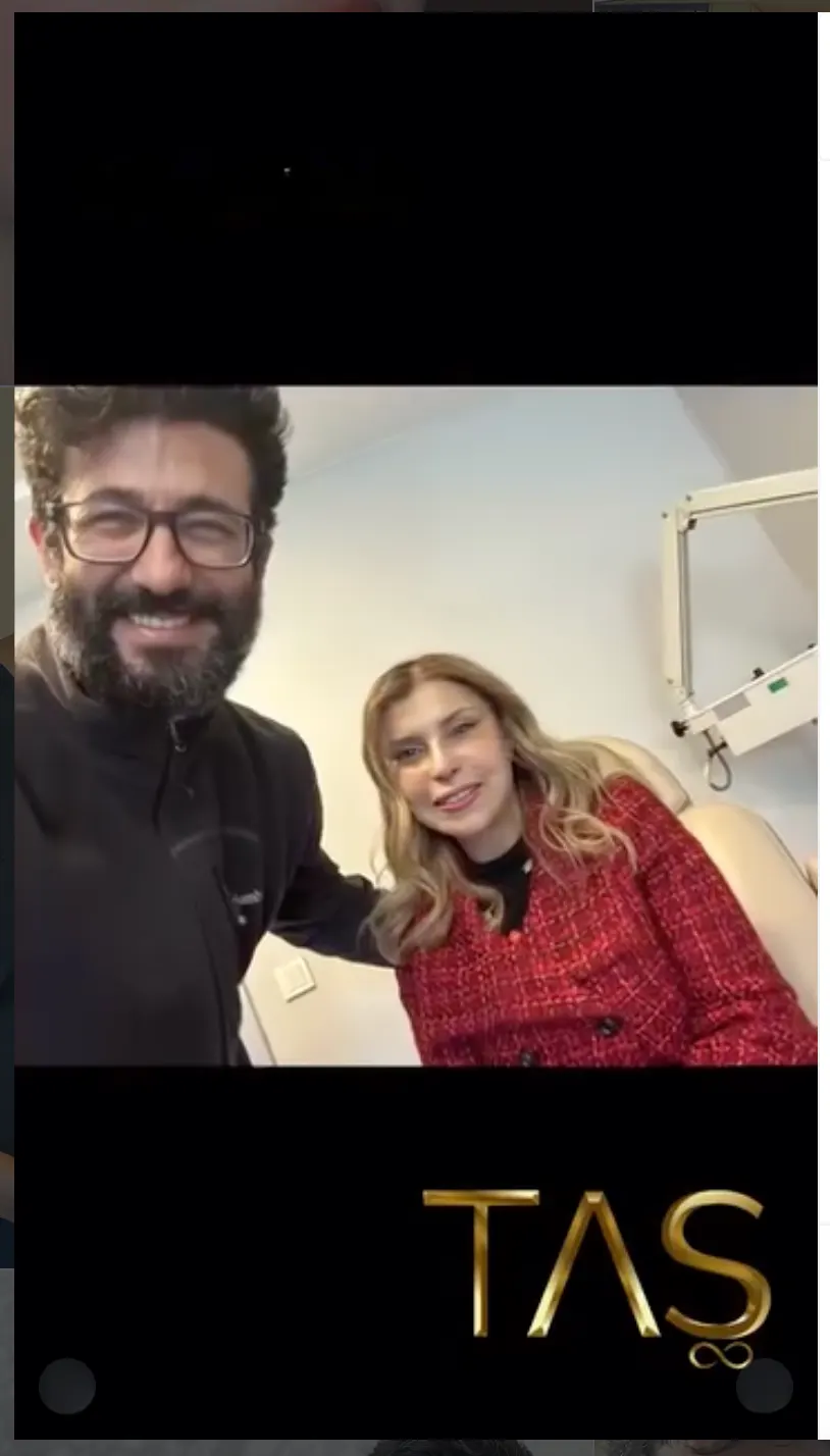 Suleyman Tas reviews – verified facelift patient review #28