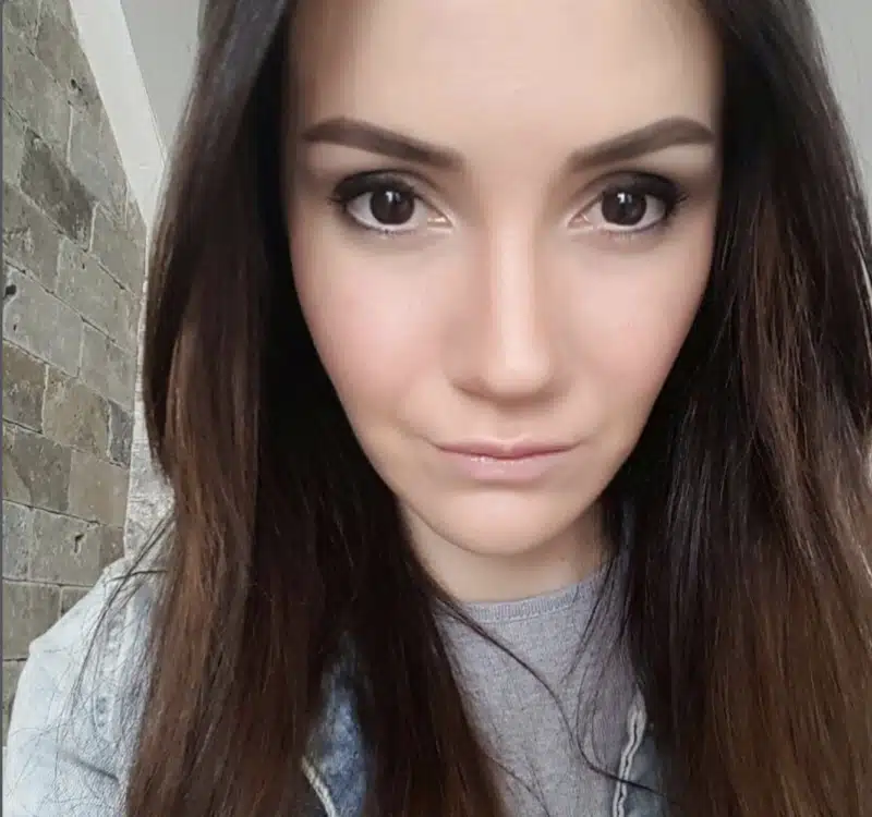 Suleyman Tas reviews – verified rhinoplasty patient review #241