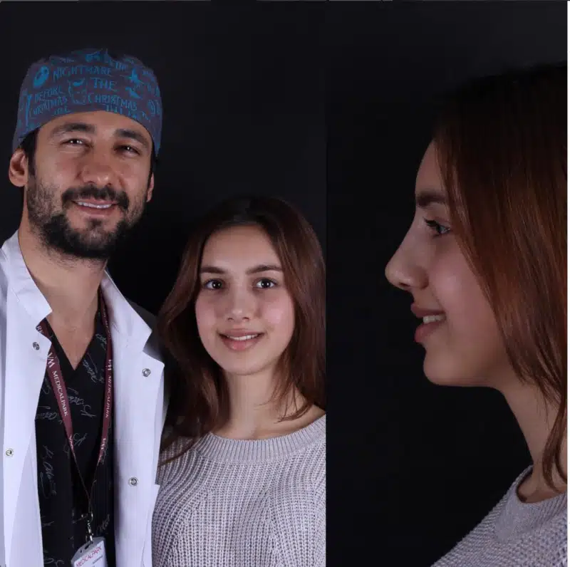 Suleyman Tas reviews – verified rhinoplasty patient review #361