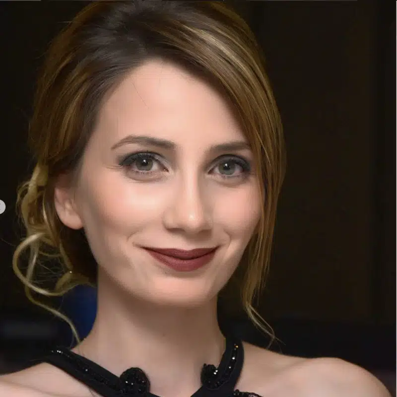 Suleyman Tas reviews – verified rhinoplasty patient review #195 (photo 2)