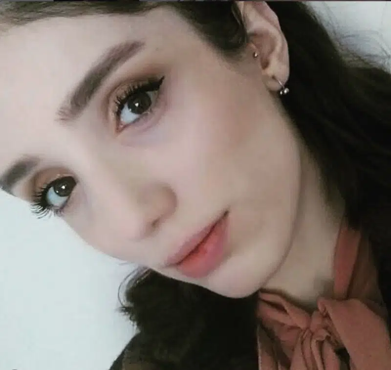 Suleyman Tas reviews – verified rhinoplasty patient review #256